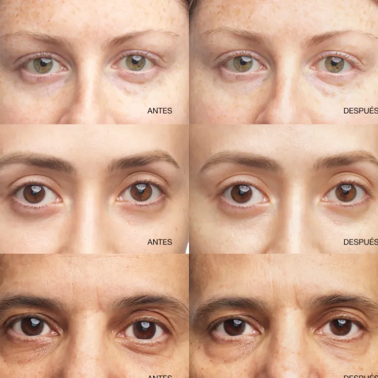 All About Eyes Brightening Serum