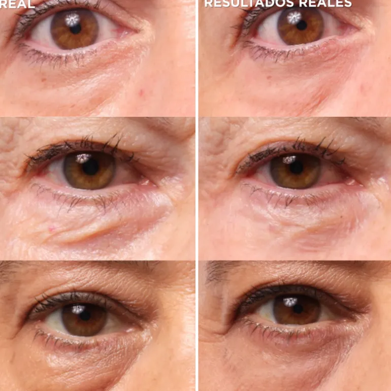 BYE BYE UNDER EYE BAGS