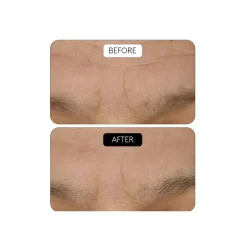 Clinical Beauty Filler