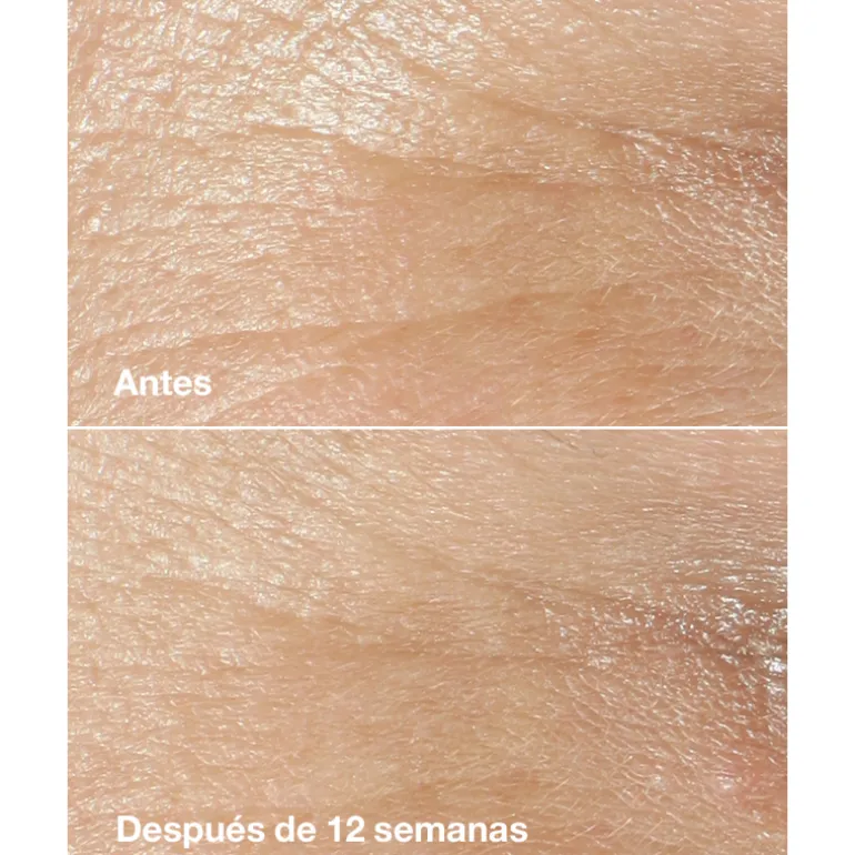 CREMA ANTIEDAD SMART CLINICAL REPAIR WRINKLE CORRECTING CREAM EDICIÓN LIMITADA