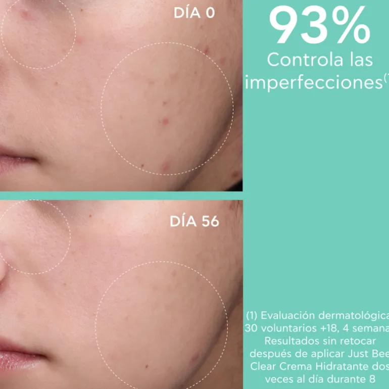 Just Bee Clear Crema Anti-Imperfecciones Matificante Hidratante