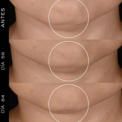 RENERGIE CREAM REFILL