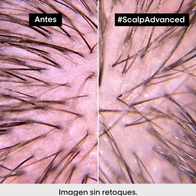 SCALP ADVANCED ANTI-DISCOMFORT CONDITIONER