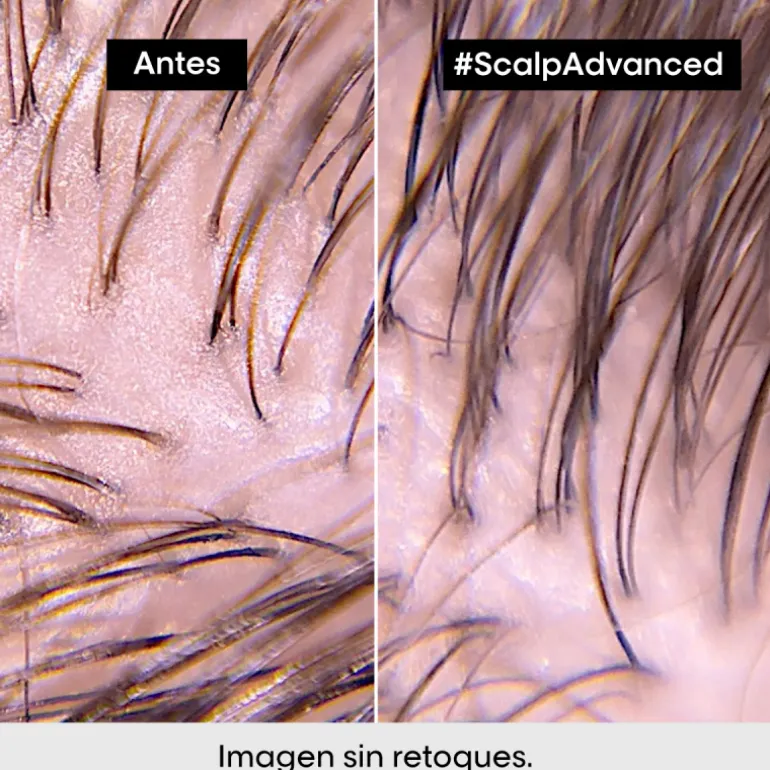 SCALP ADVANCED ANTI-OILINESS 2-IN-1