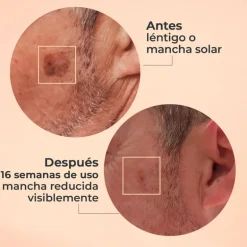 SEGLE GLICOLMIX EXFOLIANT SÉRUM