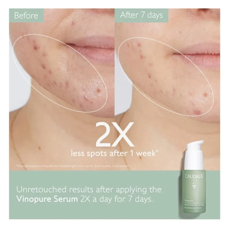 Set Sérum Vimopure + Vinopure Stop Granos Regalo