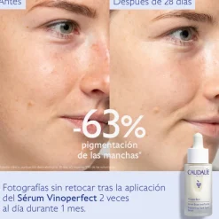 Vinoperfect Sérum Antimanchas